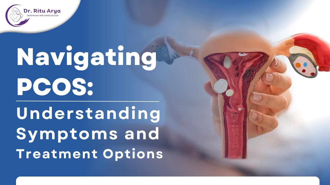 Navigating PCOS: Understanding Symptoms and Treatment Options
